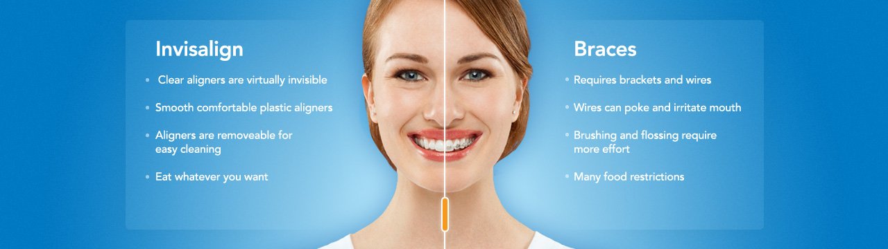 Invisalign Elite Dental Care Dr. Chelsea Perry